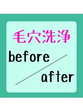 ピアリーノ(Pialino)/