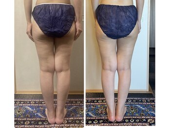 ローズ 下松(ROSE)/【筋膜リリースダイエット】