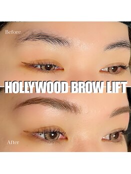 ヴィータ(VITA)/ハリウッドブロウリフト