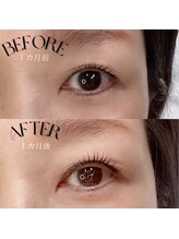 ビレイナ(BIREINA)/＊美容液の効果＊