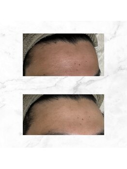 サラン(SALON)/メンズ ビフォーアフター