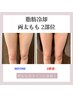 ≪美容クリニック提携≫脂肪冷却　両太もも　￥11000-
