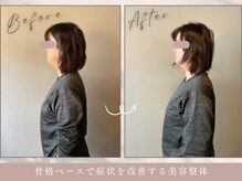 ほぐし屋 かすがい/猫背巻き肩矯正