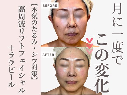 エングラッシー(en glassy)の写真