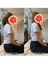 グレフル鍼灸接骨院 整体院 心斎橋/整体/肩こり/マッサージ/腰痛