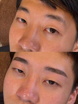 プラスアイビー 新潟店(+i.b)の写真/【似合わせアイブロウWAX脱毛1回】“骨格診断”から導き出したメンズにピッタリの《理想のデザイン脱毛》♪
