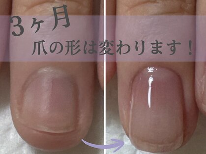 アメジスト(Amethyst)の写真