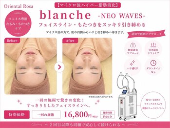 オリエンタルローザ 表参道(Oriental Rosa)/エステ最高峰小顔術マイクロ波！