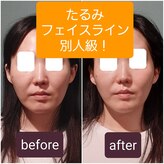 エルアンドエス(L&S)