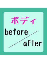 ピアリーノ(Pialino)/