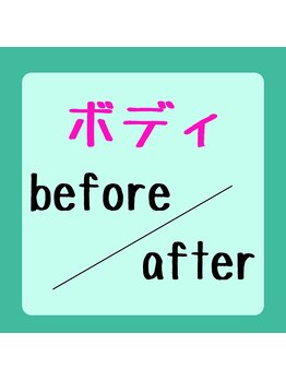 ピアリーノ(Pialino)/