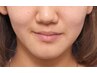 【学割U24】顔の歪み/口の歪み、目やほほの高さの左右差が気になる方へ