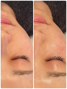 アールヨンマルハチ フェイスアンドアイ(R408.face&eye)/凸凹肌が1回でここまで！