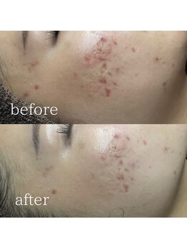 エメリーヌ(AIMELINE)/クリスティーナ ビオフィート