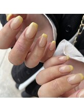 アイディー(i-dee)/イエローフレンチ