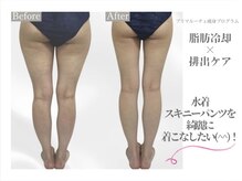 プリマルーチェの雰囲気（☆実績多数のビフォーアフターは、ブログまで！！）