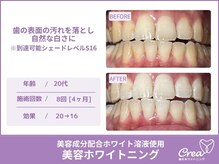 クレア(Crea)/【ホワイトニング症例写真】