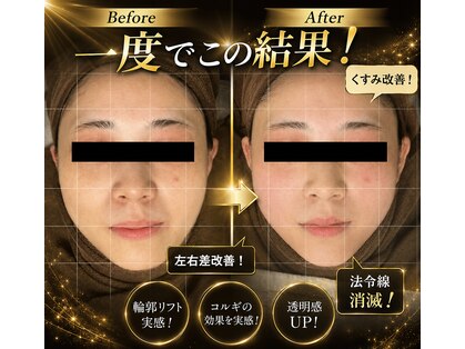 チョアチョア 札幌すすきの店(CHOA-CHOA)の写真