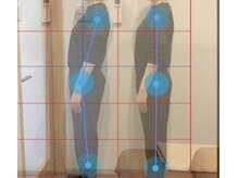 ホリスティックボディ ライカ(Lycka)の雰囲気（美容整体で肩こり、巻き肩、骨盤の歪みを改善して美姿勢に♪）