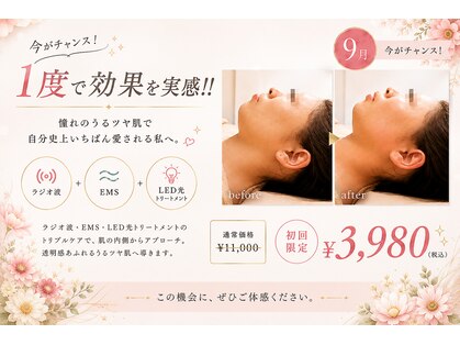 レディアンスの写真