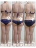 ★【全身痩身】内臓代謝upWINBACK脂肪燃焼ケア＋姿勢改善150分¥21000