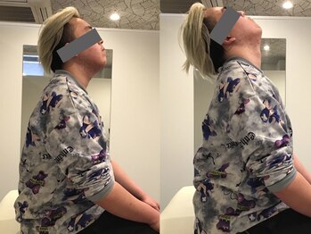 ミライズ整体院 三宮本院/事例【20代男性・スマホ首】