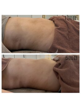 美温(mion)/冷えが強かった胃の周り