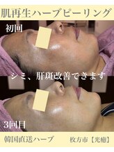 光癒(コウユ)/3回Before.After