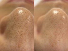 フェリス(FELIZ)/毛穴で印象も変わる