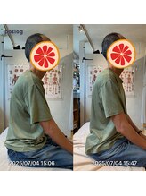 グレフル鍼灸接骨院 整体院 心斎橋/整体/肩こり/マッサージ/腰痛