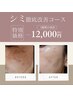 【当店人気NO,1】シミ徹底改善の光スペシャルコース