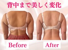 エクラパピヨン 荻窪(Eclatpapillon)の雰囲気（痩せながらバストアップ/育乳整体）