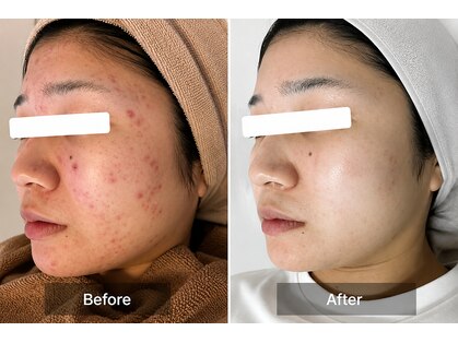 ココ 梅田中津(COCO.)の写真