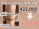 ページミューの写真/【針を使わない脂肪分解】二重アゴや頬の厚みに悩んでいる方におすすめ!速攻で小顔を実感いただけます!