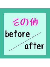 ピアリーノ(Pialino)/