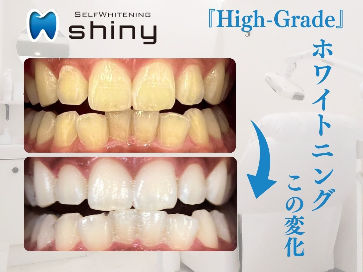 ホワイトニングサロン シャイニー 浜松細島店(shiny)｜ホットペッパー
