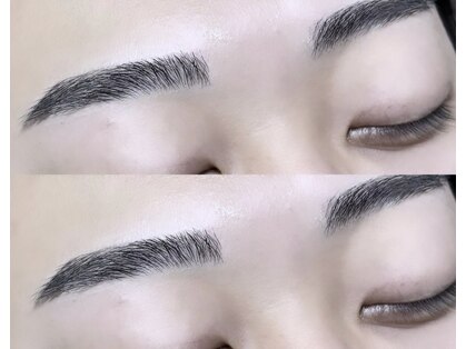 フィールリファイン(Feel Refine)の写真