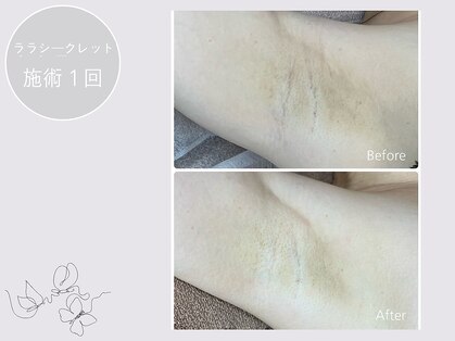 エクラルム(Eclaleum)の写真
