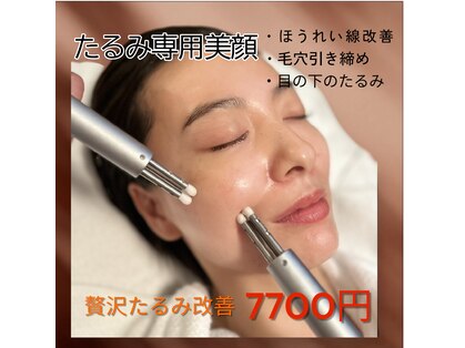 エトワール(Etoile)の写真