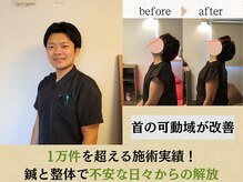 １万件を超える施術実績！技術には自信ありな院長が全て対応！