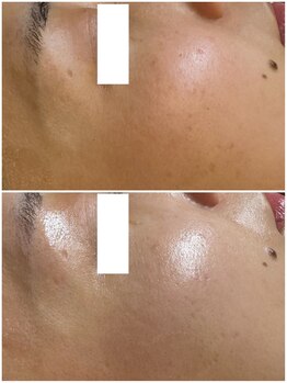 リノ(lino)/毛穴のザラつき、くすみオフ