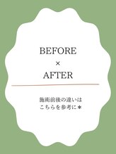 アトリエマッジョ(Atelier Maggio)/お爪、お手元のBEFORE、AFTER