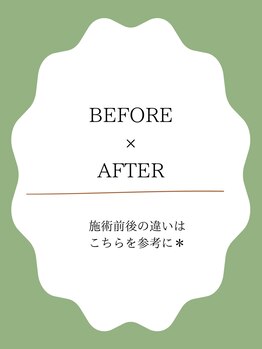 アトリエマッジョ(Atelier Maggio)/お爪、お手元のBEFORE、AFTER
