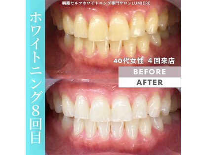 ルミエール 朝霧(Lumiere)の写真