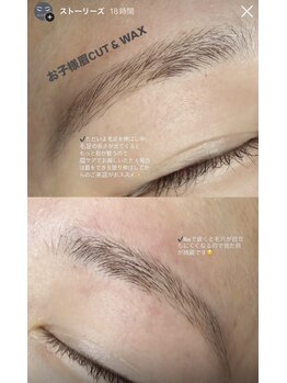 エーラッシュ(A-Lash)/お子様眉カット&WAX脱毛