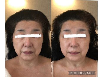 シベル(Si Belles)/60代後半/1回の結果