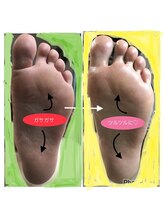 リゼラアンドコー 宇都宮店/かかと角質ケア/足裏角質除去！