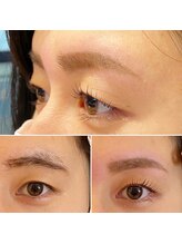 美眉アンド美肌専門サロンすみれ/ビフォーアフター