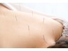 胃腸の不具合◆胃腸を整える鍼◆¥6000