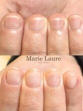 マリーロール 梅田店(Marie Laure)/深爪矯正/自爪育成/自爪風